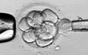 La Fundació Puigvert i l’Hospital de Sant Pau realitzen per primera vegada a Espanya el diagnòstic genètic preimplantacional en una portadora del BRCA